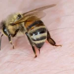 Асалари заҳари йилнинг асосий гўзаллик таркибий қисмига айланмоқда