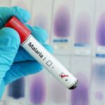 ЖССТ: Дунёда безгакдан ўлим ҳолатлари ортмоқда