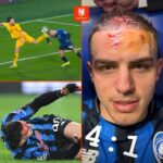 ЧЕМПИОНЛАР ЛИГАСИДА ҚОНЛИ ДРАМА! &laquo;АТАЛАНТА&raquo;НИНГ ЧОРАК ФИНАЛГА ЙЎЛИ ҚОН БИЛАН ЮВИЛДИ!