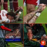 &laquo;Галатасарой&raquo; футболчиси Ноа Ланг «Ливерпуль» билан ўйинда бармоғининг бир қисмидан айрилди