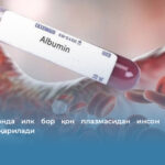 Ўзбекистонда илк бор қон плазмасидан инсон альбумини ишлаб чиқарилади