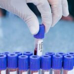 Дунёда COVID-19 нинг янги “Цикада” штамми тарқалмоқда – BBC